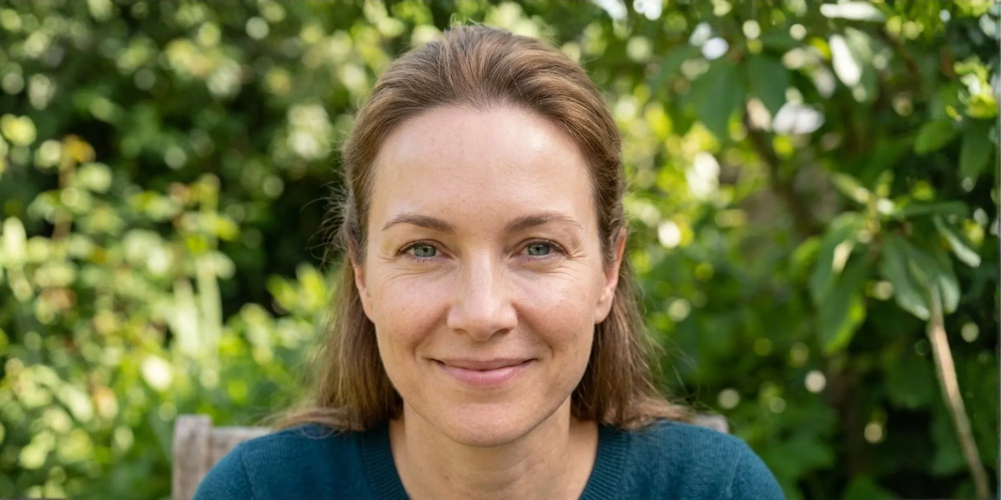 facial-rejuvenation-threads-Forehead-and-Brow-Smoothing