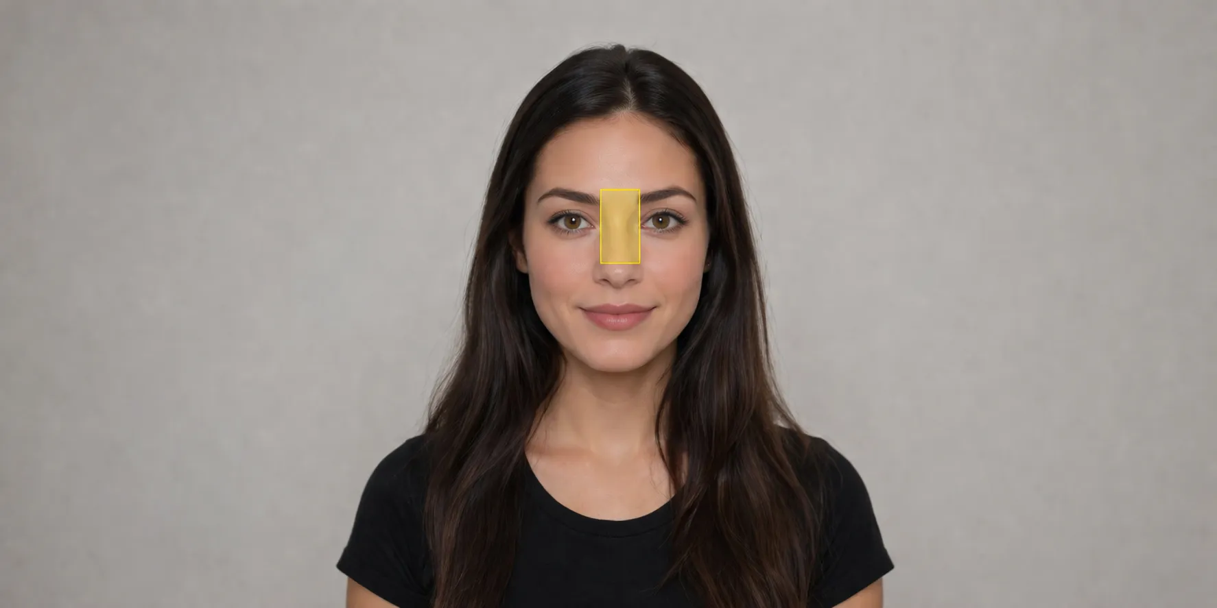 Radix Area (Upper Nose Between the Eyes)