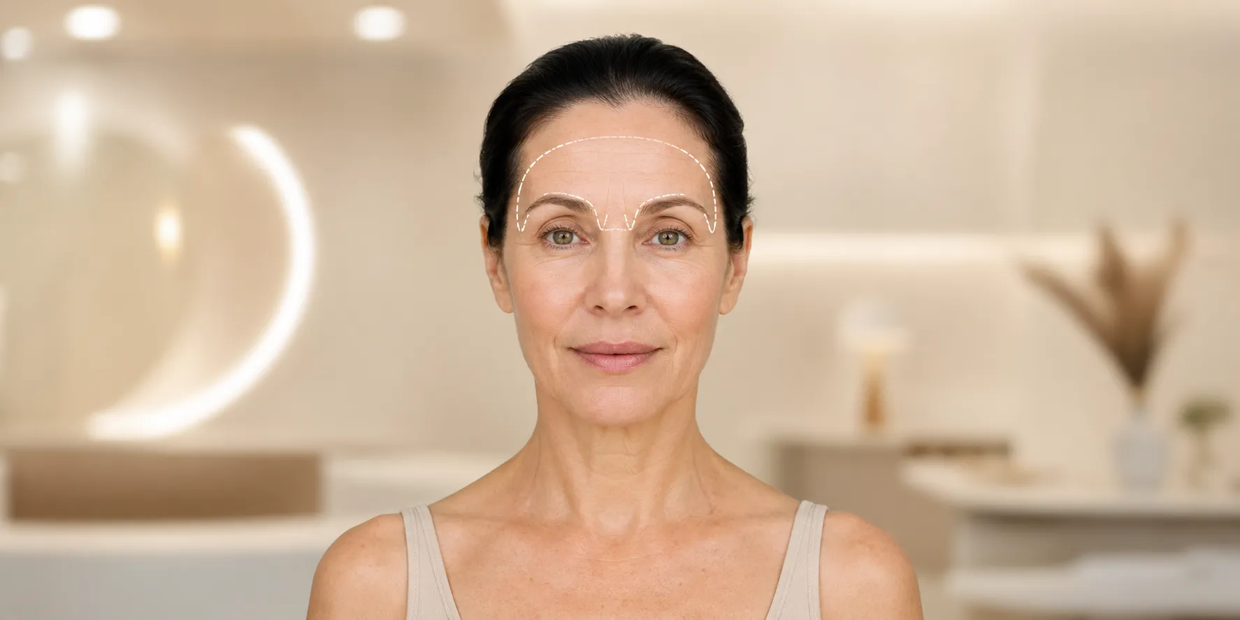 hifu-treatment Forehead-Brows