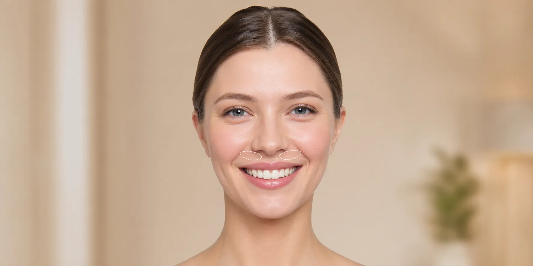 The-Gummy-Smile-Correction-Botox