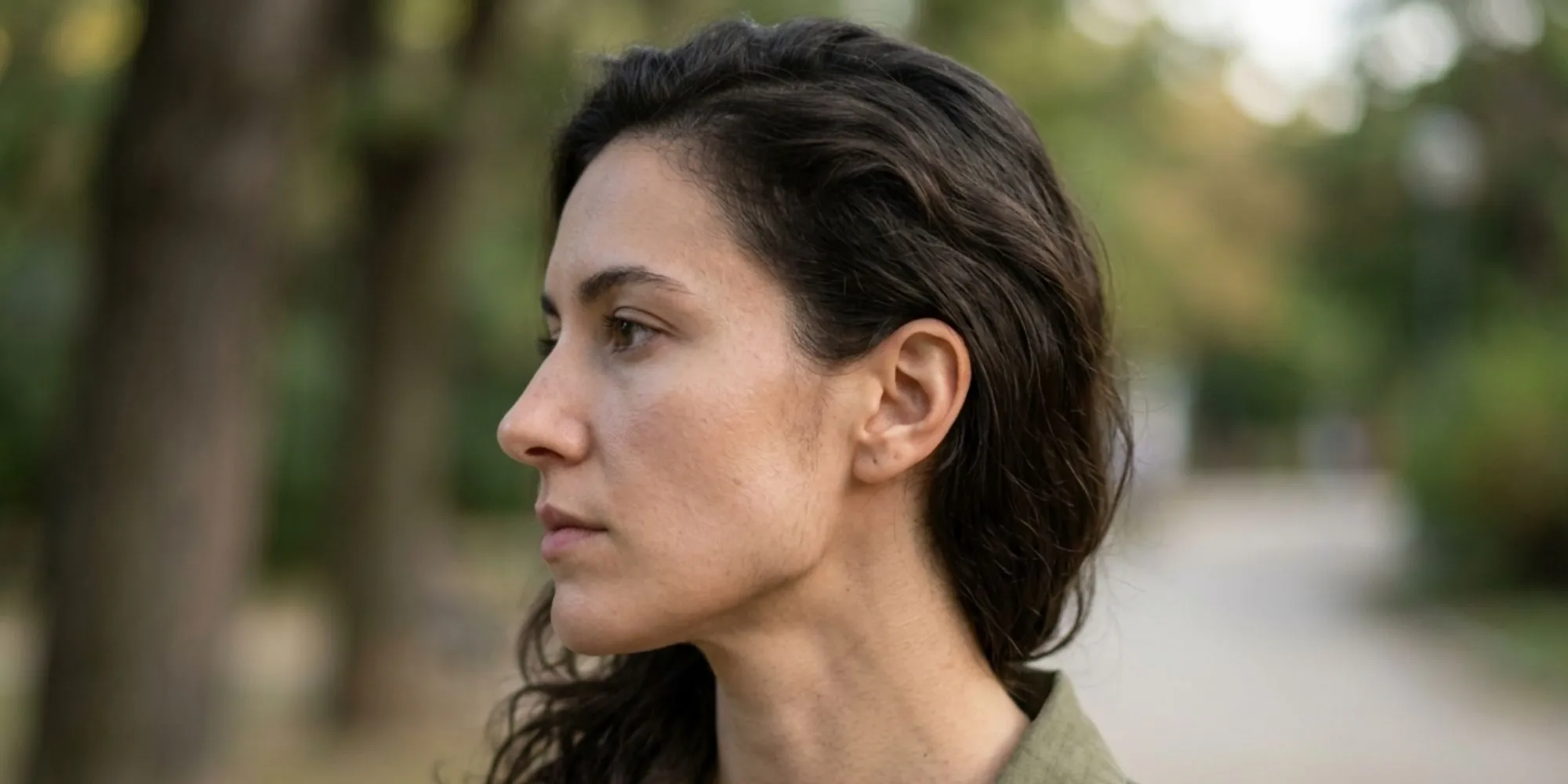 jawline-filler-Jawline-Symmetry-Correction
