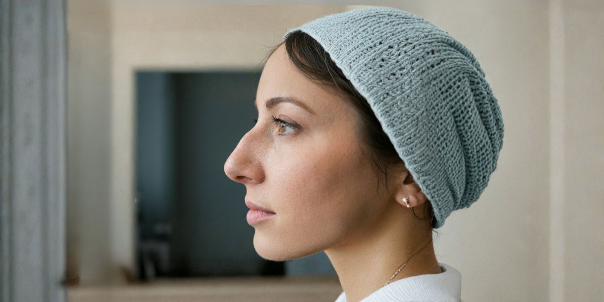 nose-filler-Nasal-Bridge