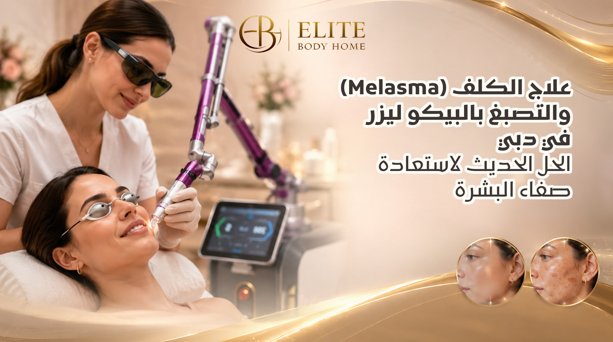 علاج الكلف (Melasma) والتصبغ بالبيكو ليزر في دبي: الحل الحديث لاستعادة صفاء البشرة