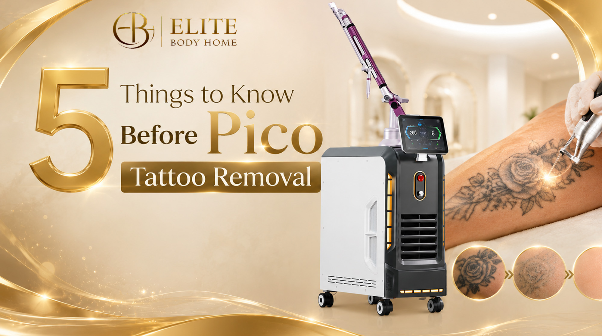 5 Things to Know Before Pico Tattoo Removal