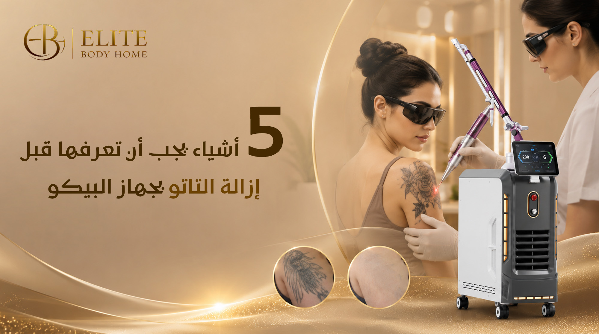 5 أشياء يجب أن تعرفها قبل إزالة التاتو بجهاز البيكو