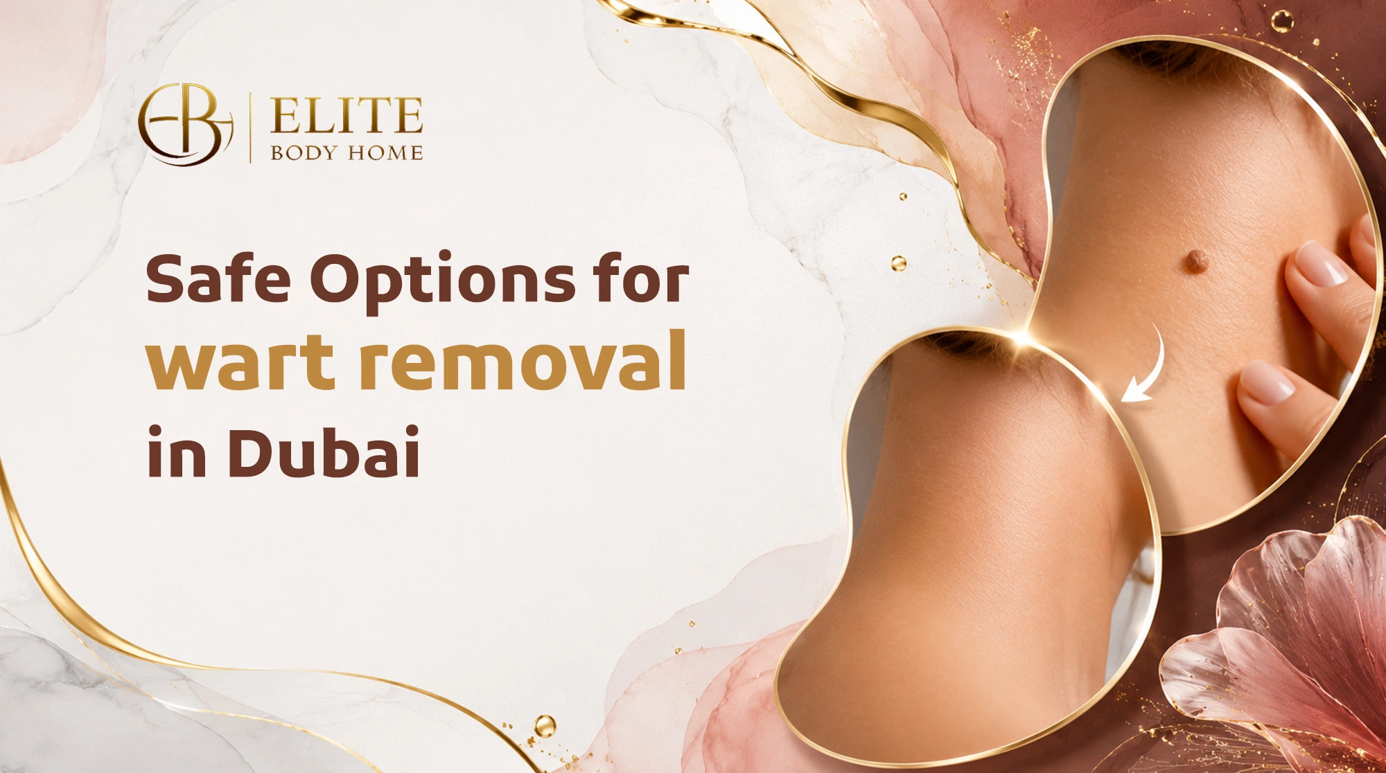 Safe Options for wart removal in Dubai